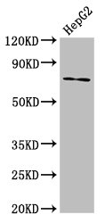 ABCG5 Antibody - Positive Western Blot detected in HepG2 whole cell lysate. All lanes: ABCG5 antibody at 8.7 µg/ml Secondary Goat polyclonal to rabbit IgG at 1/50000 dilution. Predicted band size: 73, 29 KDa. Observed band size: 73 KDa