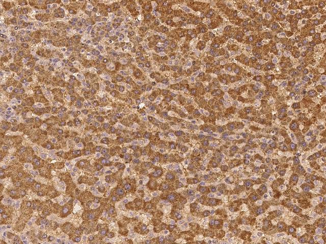 ABCG5 Antibody - Immunochemical staining of human ABCG5 in human liver with rabbit polyclonal antibody at 1:100 dilution, formalin-fixed paraffin embedded sections.