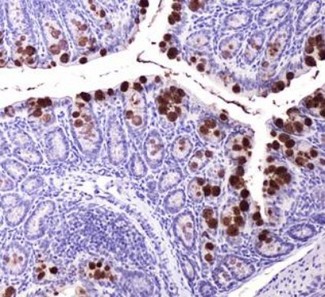 ABCG8 Antibody - Immunohistochemistry: ABCG8 Antibody (1B10A5) - IHC of ABCG8 in mouse intestine.  This image was taken for the unconjugated form of this product. Other forms have not been tested.