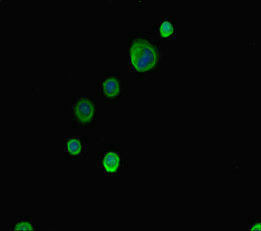 ABCG8 Antibody - Immunofluorescent analysis of MCF7 cells diluted at 1:100 and Alexa Fluor 488-congugated AffiniPure Goat Anti-Rabbit IgG(H+L)
