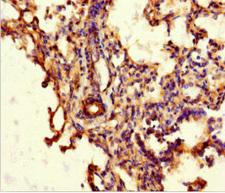 ABCG8 Antibody - Immunohistochemistry of paraffin-embedded human lung tissue at dilution 1:100