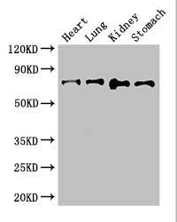 ABCG8 Antibody - Western Blot Positive WB detected in:Mouse heart tissue,Mouse lung tissue,Mouse kidney tissue,Mouse stomach tissue All Lanes: ABCG8 antibody at 2.8ug/ml Secondary Goat polyclonal to rabbit IgG at 1/50000 dilution Predicted band size: 76 kDa Observed band size: 76 kDa