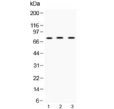 ABCG8 Antibody - Western blot testing of 1) rat liver, 2) mouse liver and 3) human placenta lysate with ABCG8 antibody at 0.5ug/ml. Predicted molecular weight ~76 kDa.