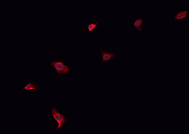 ABCG8 Antibody - Staining HepG2 cells by IF/ICC. The samples were fixed with PFA and permeabilized in 0.1% Triton X-100, then blocked in 10% serum for 45 min at 25°C. The primary antibody was diluted at 1:200 and incubated with the sample for 1 hour at 37°C. An Alexa Fluor 594 conjugated goat anti-rabbit IgG (H+L) antibody, diluted at 1/600, was used as secondary antibody.