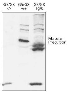 ABCG8 Antibody - Western blot of ABCG8, using ABCG8 antibody. Samples: mouse liver microsomes from G5/G8 knockout mice, wild type human G5/G8, and transgenic human G5/G8.  This image was taken for the unconjugated form of this product. Other forms have not been tested.
