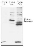 ABCG8 Antibody - Western blot of ABCG8, using ABCG8 antibody. Samples: mouse liver microsomes from G5/G8 knockout mice, wild type human G5/G8, and transgenic human G5/G8.  This image was taken for the unconjugated form of this product. Other forms have not been tested.