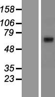 ABCG8 Protein - Western validation with an anti-DDK antibody * L: Control HEK293 lysate R: Over-expression lysate