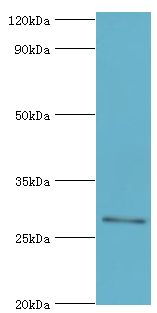 ABH2 / ALKBH2 Antibody - Western blot. All lanes: Alpha-ketoglutarate-dependent dioxygenase alkB homolog 2 antibody at 2 ug/ml+HeLa whole cell lysate. Secondary antibody: Goat polyclonal to rabbit at 1:10000 dilution. Predicted band size: 29 kDa. Observed band size: 29 kDa Immunohistochemistry.