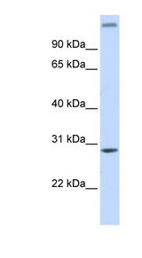 ABH2 / ALKBH2 Antibody - ALKBH2 antibody Western blot of Fetal Brain lysate. This image was taken for the unconjugated form of this product. Other forms have not been tested.