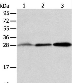 ABH2 / ALKBH2 Antibody - Western blot analysis of Human fetal liver and seminoma tissue, RAW264.7 cell, using ALKBH2 Polyclonal Antibody at dilution of 1:800.