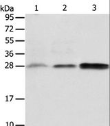 ABH2 / ALKBH2 Antibody - Western blot analysis of Human fetal liver and seminoma tissue, RAW264.7 cell, using ALKBH2 Polyclonal Antibody at dilution of 1:650.