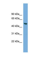 ABHD1 Antibody - ABHD1 antibody Western blot of HepG2 cell lysate. This image was taken for the unconjugated form of this product. Other forms have not been tested.