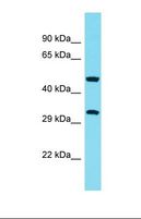 ABHD10 Antibody - Western blot of Human THP-1. ABHD10 antibody dilution 1.0 ug/ml.  This image was taken for the unconjugated form of this product. Other forms have not been tested.