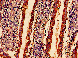 ABHD10 Antibody - Immunohistochemistry analysis of human small intestine tissue at a dilution of 1:100