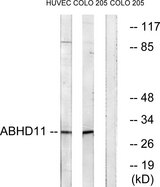 ABHD11 Antibody - Western blot analysis of lysates from COLO and HUVEC cells, using ABHD11 Antibody. The lane on the right is blocked with the synthesized peptide.