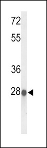 ABHD11 Antibody - Western blot of ABHDB Antibody in MCF-7 cell line lysates (35 ug/lane). ABHDB (arrow) was detected using the purified antibody.