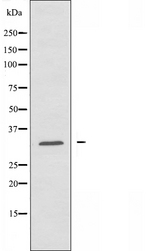 ABHD11 Antibody - Western blot analysis of extracts of HuvEc cells using ABHD11 antibody.