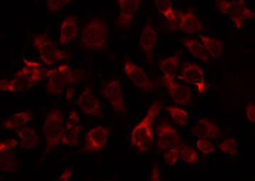 ABHD11 Antibody - Staining COLO205 cells by IF/ICC. The samples were fixed with PFA and permeabilized in 0.1% Triton X-100, then blocked in 10% serum for 45 min at 25°C. The primary antibody was diluted at 1:200 and incubated with the sample for 1 hour at 37°C. An Alexa Fluor 594 conjugated goat anti-rabbit IgG (H+L) Ab, diluted at 1/600, was used as the secondary antibody.