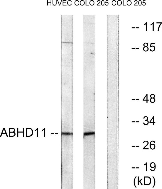ABHD11 Antibody - Western blot analysis of extracts from HUVEC cells and COLO cells, using ABHD11 antibody.