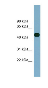 ABHD12 Antibody - ABHD12 antibody Western blot of Fetal Spleen lysate. This image was taken for the unconjugated form of this product. Other forms have not been tested.