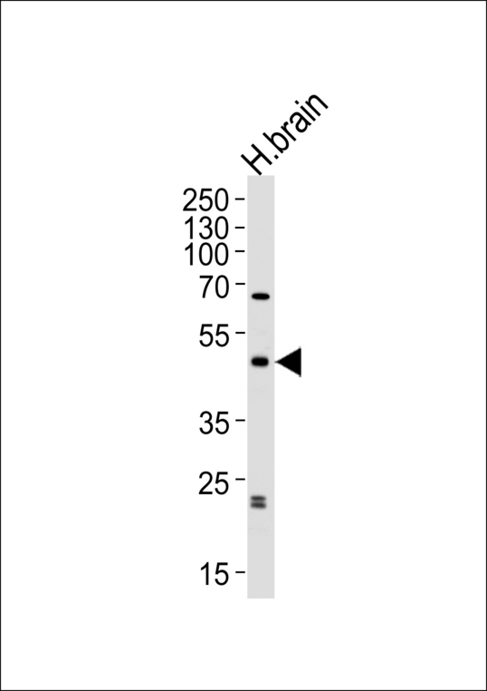 ABHD12 Antibody - Western blot of lysate from human brain tissue lysate, using ABHD12 Antibody. Antibody was diluted at 1:1000 at each lane. A goat anti-rabbit IgG H&L (HRP) at 1:5000 dilution was used as the secondary antibody. Lysate at 35ug per lane.