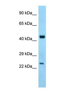 ABHD12 Antibody - ABHD12 antibody Western blot of Mouse Thymus lysate. Antibody concentration 1 ug/ml.  This image was taken for the unconjugated form of this product. Other forms have not been tested.
