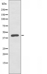 ABHD12 Antibody - Western blot analysis of extracts of COLO cells using ABHD12 antibody.
