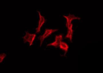 ABHD12 Antibody - Staining COLO205 cells by IF/ICC. The samples were fixed with PFA and permeabilized in 0.1% Triton X-100, then blocked in 10% serum for 45 min at 25°C. The primary antibody was diluted at 1:200 and incubated with the sample for 1 hour at 37°C. An Alexa Fluor 594 conjugated goat anti-rabbit IgG (H+L) Ab, diluted at 1/600, was used as the secondary antibody.