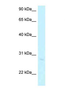 ABHD12B Antibody - ABHD12B antibody Western blot of Jurkat Cell lysate. Antibody concentration 1 ug/ml.  This image was taken for the unconjugated form of this product. Other forms have not been tested.