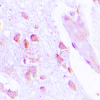 ABHD12B Antibody - Immunohistochemical analysis of ABHD12B staining in human brain formalin fixed paraffin embedded tissue section. The section was pre-treated using heat mediated antigen retrieval with sodium citrate buffer (pH 6.0). The section was then incubated with the antibody at room temperature and detected using an HRP conjugated compact polymer system. DAB was used as the chromogen. The section was then counterstained with hematoxylin and mounted with DPX.