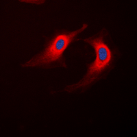 ABHD12B Antibody - Immunofluorescent analysis of ABHD12B staining in K562 cells. Formalin-fixed cells were permeabilized with 0.1% Triton X-100 in TBS for 5-10 minutes and blocked with 3% BSA-PBS for 30 minutes at room temperature. Cells were probed with the primary antibody in 3% BSA-PBS and incubated overnight at 4 C in a humidified chamber. Cells were washed with PBST and incubated with a DyLight 594-conjugated secondary antibody (red) in PBS at room temperature in the dark. DAPI was used to stain the cell nuclei (blue).