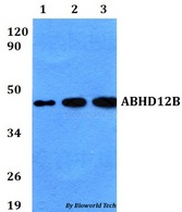 ABHD12B Antibody - Western blot of ABHD12B antibody at 1:500 dilution. Lane 1: A549 whole cell lysate. Lane 2: sp2/0 whole cell lysate. Lane 3: PC12 whole cell lysate.