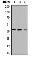 ABHD13 Antibody - Western blot analysis of ABHD13 expression in HEK293T (A); Raw264.7 (B); H9C2 (C) whole cell lysates.