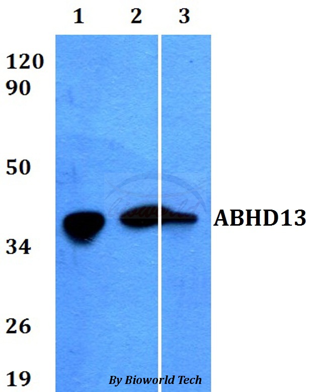 ABHD13 Antibody - Western blot of ABHD13 antibody at 1:500 dilution. Lane 1: HEK293T whole cell lysate. Lane 2: Raw264.7 whole cell lysate. Lane 3: H9C2 whole cell lysate.