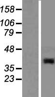 ABHD13 Protein - Western validation with an anti-DDK antibody * L: Control HEK293 lysate R: Over-expression lysate