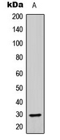 ABHD14A Antibody - Western blot analysis of ABHD14A expression in A549 (A) whole cell lysates.