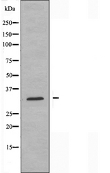 ABHD14A Antibody - Western blot analysis of extracts of RAW264.7 cells using ABHD14A antibody.
