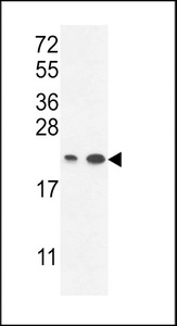ABHD14B Antibody - ABHEB Antibody western blot of A2058,T47D cell line lysates (35 ug/lane). The ABHEB antibody detected the ABHEB protein (arrow).