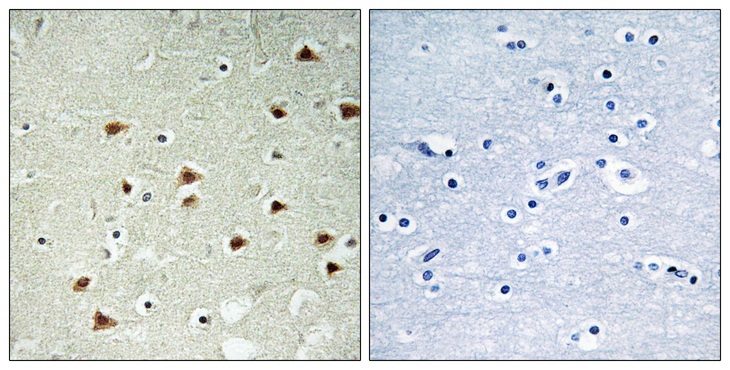 ABHD14B Antibody - Immunohistochemistry analysis of paraffin-embedded human brain tissue, using ABHD14B Antibody. The picture on the right is blocked with the synthesized peptide.