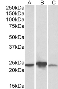 ABHD14B Antibody - Goat Anti-ABHD14B (aa188-200) Antibody (0.3µg/ml) staining of Human (A), Mouse(B), Rat (C) Liver lysate (35µg protein in RIPA buffer). Primary incubation was 1 hour. Detected by chemiluminescencence.
