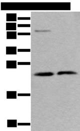 ABHD14B Antibody - Western blot analysis of LO2 cell and Human testis tissue lysates  using ABHD14B Polyclonal Antibody at dilution of 1:350