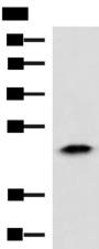 ABHD14B Antibody - Western blot analysis of Human fetal liver tissue lysate  using ABHD14B Polyclonal Antibody at dilution of 1:900