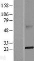 ABHD14B Protein - Western validation with an anti-DDK antibody * L: Control HEK293 lysate R: Over-expression lysate