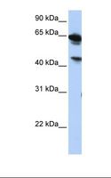 ABHD16A / BAT5 Antibody - HepG2 cell lysate. Antibody concentration: 1.0 ug/ml. Gel concentration: 12%.  This image was taken for the unconjugated form of this product. Other forms have not been tested.