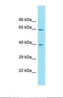 ABHD17C / FAM108C1 Antibody - Western blot of 293T. FAM108C1 antibody dilution 1.0 ug/ml.  This image was taken for the unconjugated form of this product. Other forms have not been tested.