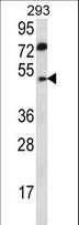 ABHD2 Antibody - ABHD2 Antibody western blot of 293 cell line lysates (35 ug/lane). The ABHD2 antibody detected the ABHD2 protein (arrow).