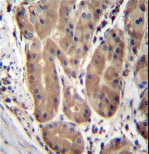 ABHD2 Antibody - ABHD2 Antibody immunohistochemistry of formalin-fixed and paraffin-embedded human stomach tissue followed by peroxidase-conjugated secondary antibody and DAB staining.