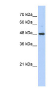 ABHD2 Antibody - ABHD2 antibody Western blot of Transfected 293T cell lysate. This image was taken for the unconjugated form of this product. Other forms have not been tested.
