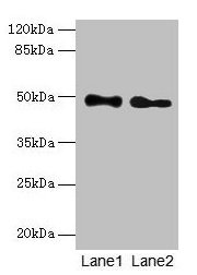 ABHD2 Antibody - Western blot All lanes: ABHD2 antibody at 10µg/ml Lane 1: Mouse heart tissue Lane 2: Rat gonadal tissue Secondary Goat polyclonal to rabbit IgG at 1/10000 dilution Predicted band size: 48 kDa Observed band size: 48 kDa