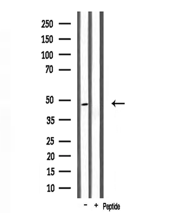 ABHD2 Antibody - Western blot analysis of extracts of mouse muscle using ABHD2 antibody.